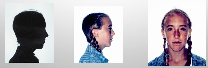 <p>-dolicocephalic: an individual that has a narrower cranial width and usually presents with a long, narrow shape and high mandibular plane angle</p><p>-dolicofacial: an individual that has a long, narrow face with a high mandibular plane angle, convex profile, poor chin development, and an anterior-posterior face height imbalance</p>