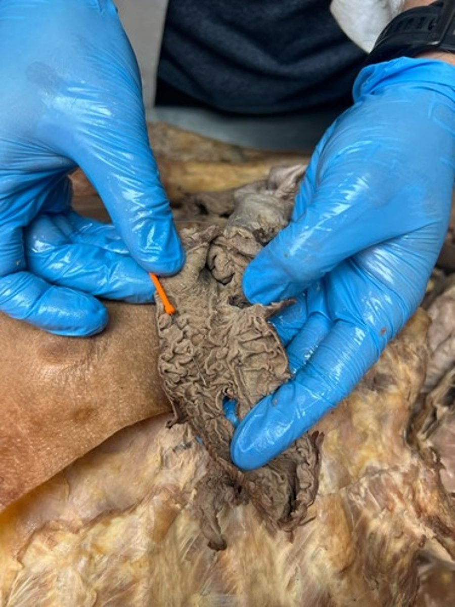 <p>circular folds of small intestine</p>