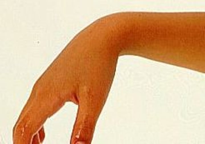<p>wrist</p>