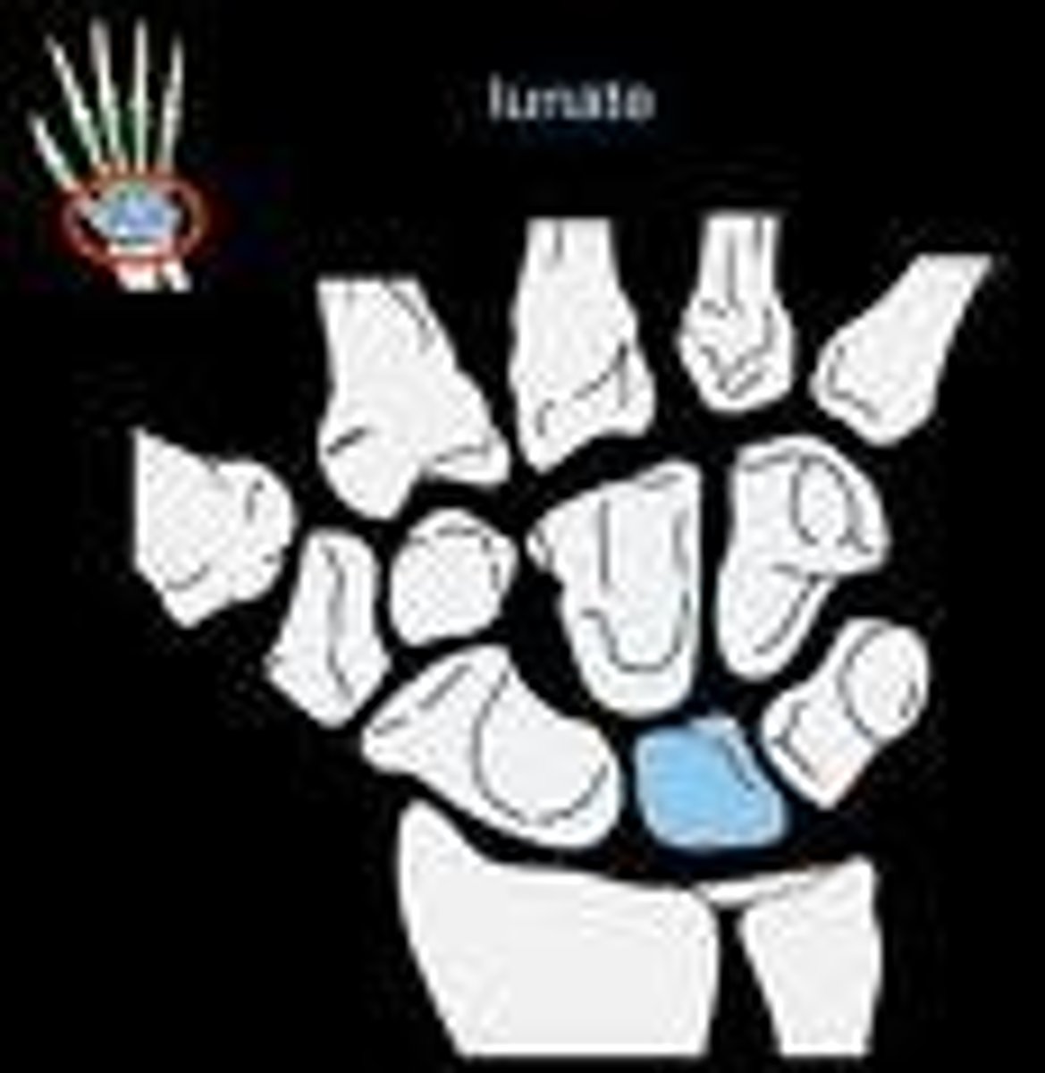 <p>- situated in the center of the proximal row carpal bones, which lie between the ulna and radius and the hand</p><p>- deep concavity and crescentic outline</p>