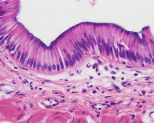 <p>Nonciliated type lines most of the digestive tract (stomach to rectum), gallbladder, and excretory ducts of some glands; ciliated variety lines small bronchi, uterine tubes, and some regions of the uterus.</p>