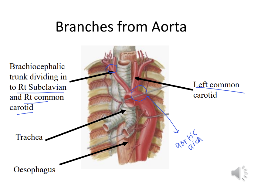 <p>brachiocephalic artery - right subclavian and right common carotid</p><p>left side, the left subclavian and the left common carotid emerge from the aortic arch directly</p>