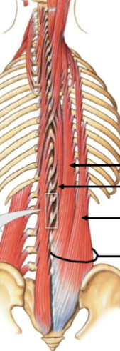 <p>Spinalis, Longissiums and Iliocostalis muscles</p>