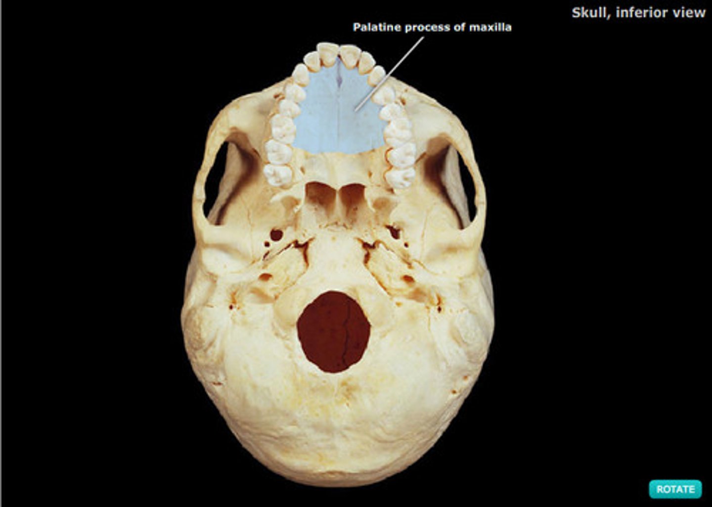 <p>(<strong>Inferior aspect of the skull, mandible removed)</strong></p>