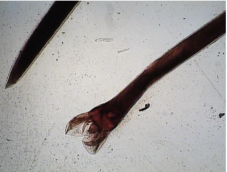 <p>Necator americanus </p>