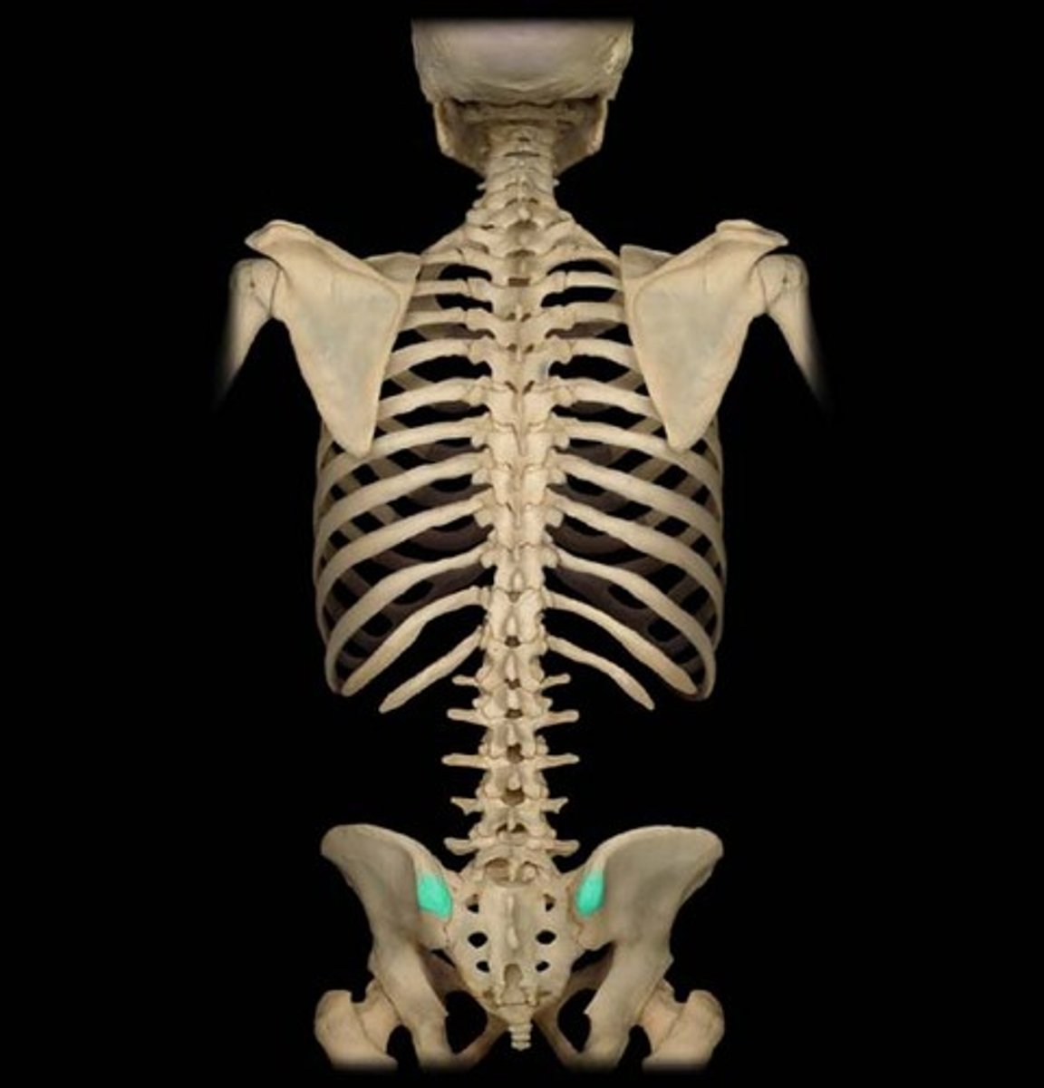 <p>find dimples of venus. the sharp posterior end of the iliac crest</p><p>gluteus maximus attaches here (hip extension) innervated by inferior gluteal nerve.</p>