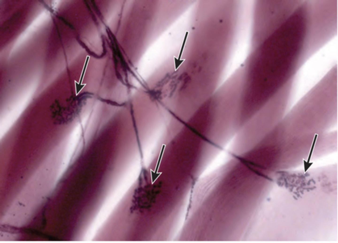 <p>A biopsy of the biceps brachii muscle is prepared using a special stain and examined in the pathology department (shown in the image). Identify the structure indicated by the arrows.</p><p>(A) Motor end plates</p><p>(B) Motor unit</p><p>(C) Muscle spindles</p><p>(D) Myelinated axons</p><p>(E) Tendon organs</p>