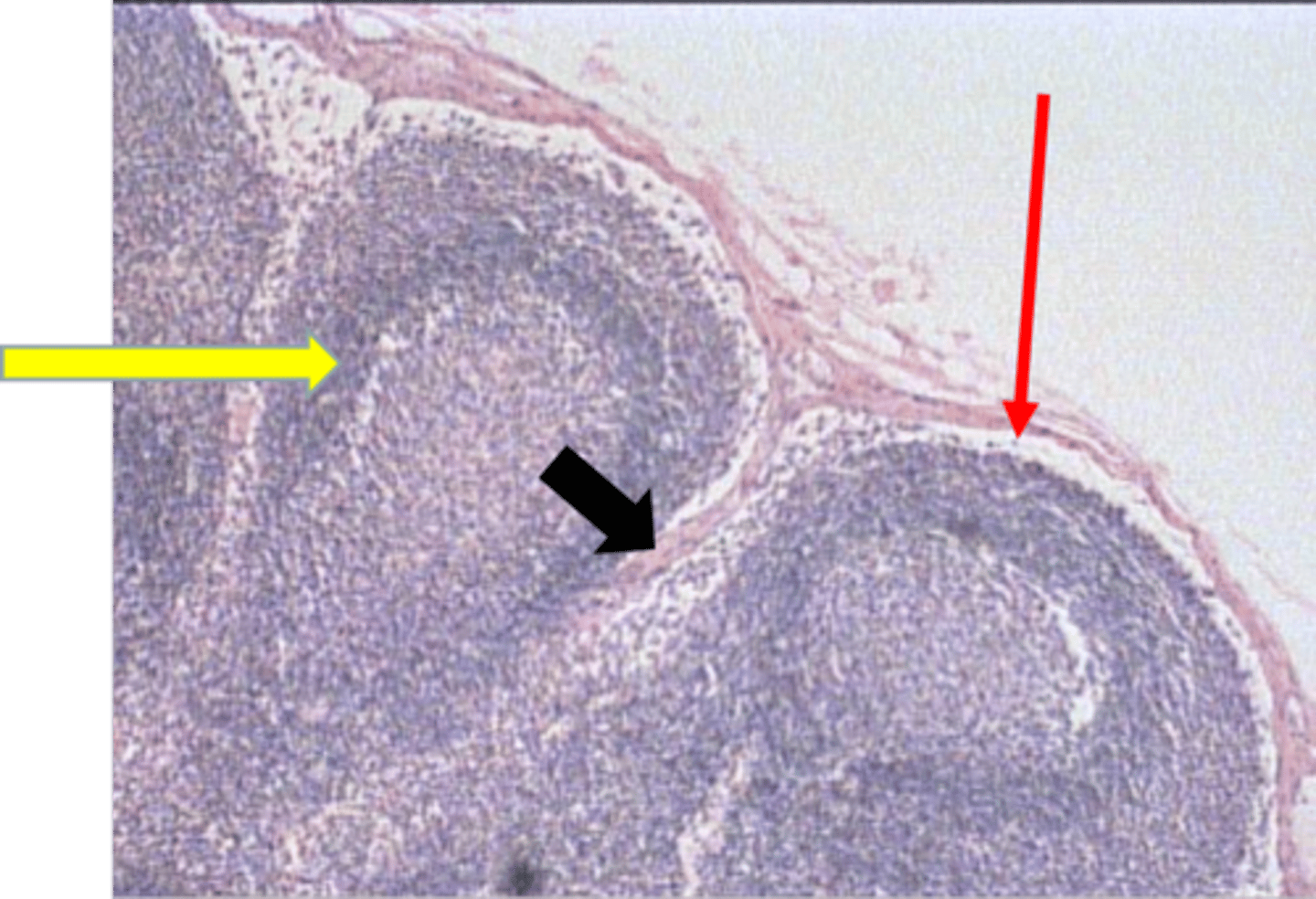 <p>tissue type</p><p>cortex of lymph</p>