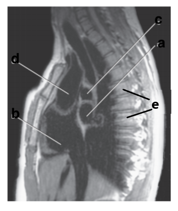 <p>What is letter a ?</p>