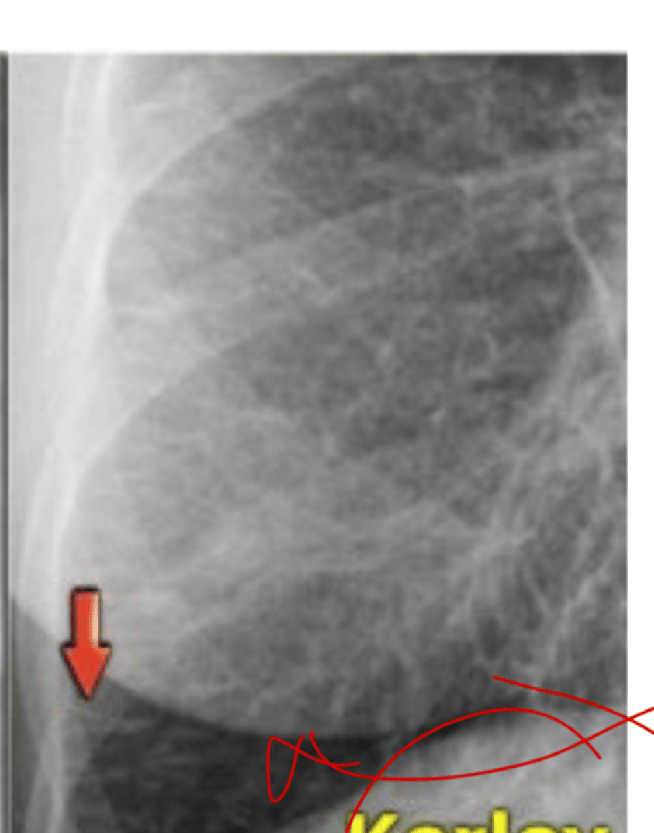 <p>what is this pointing to and what caused it?</p>