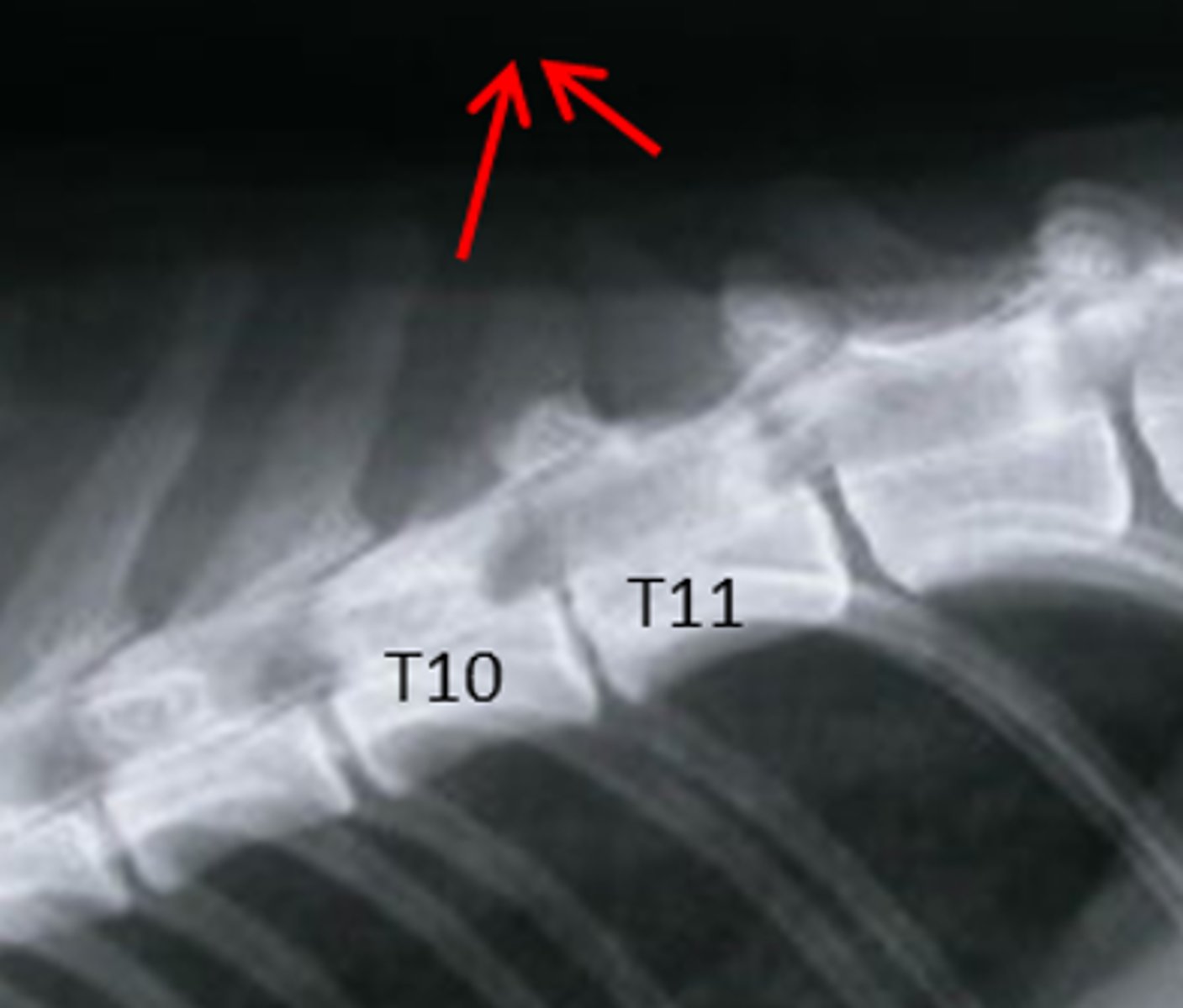 <p>The disc space is narrowed</p>