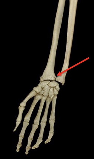 term image