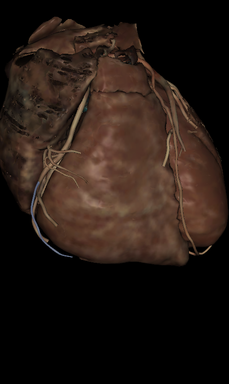 <p>Name the structure highlighted </p>