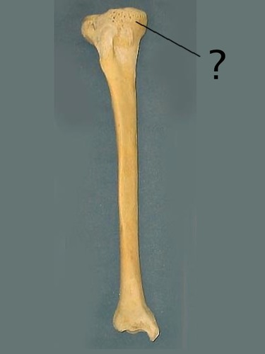 <p>on the side with medial malleolus </p>