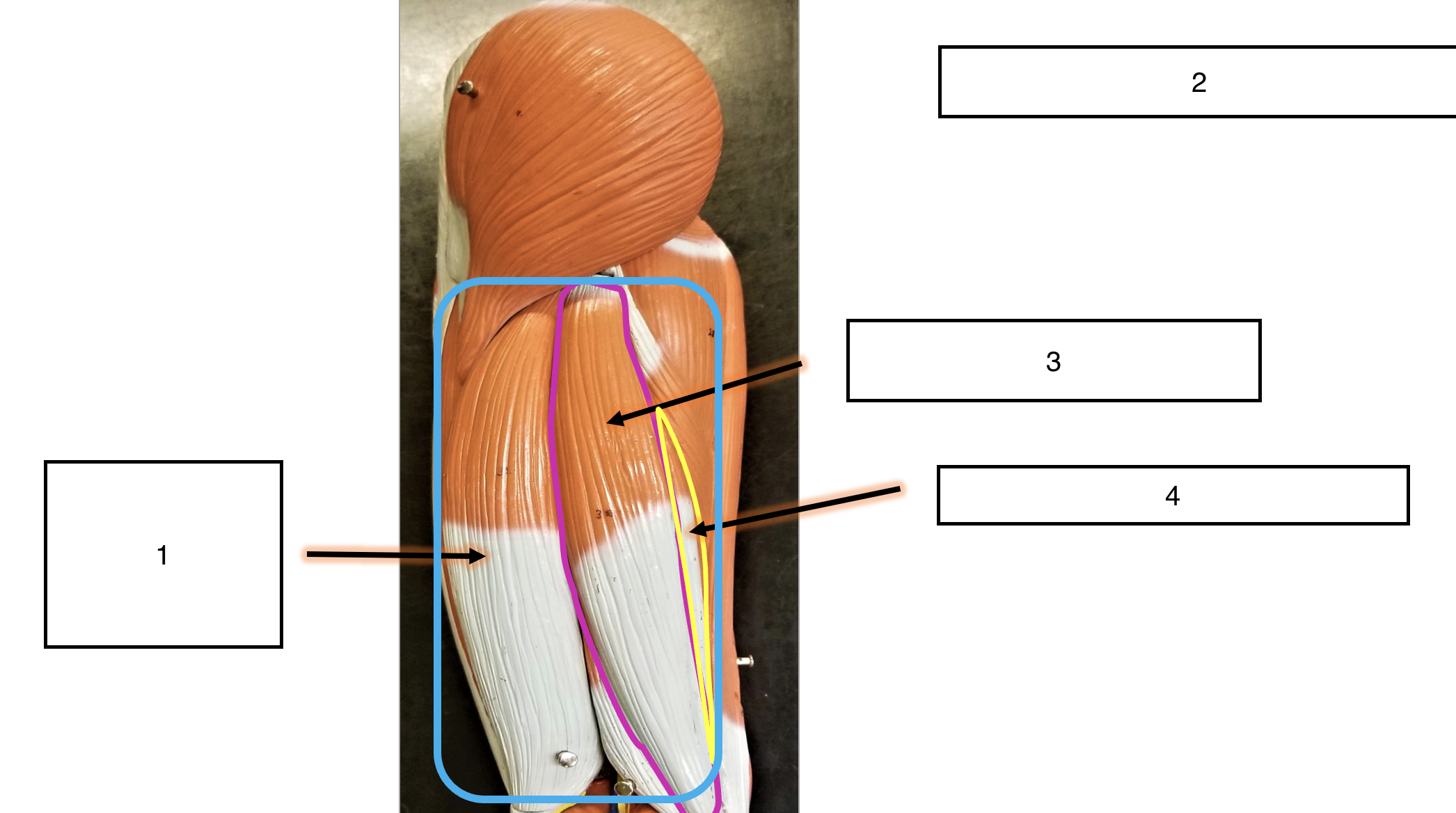 <p>name the muscle (3)</p>