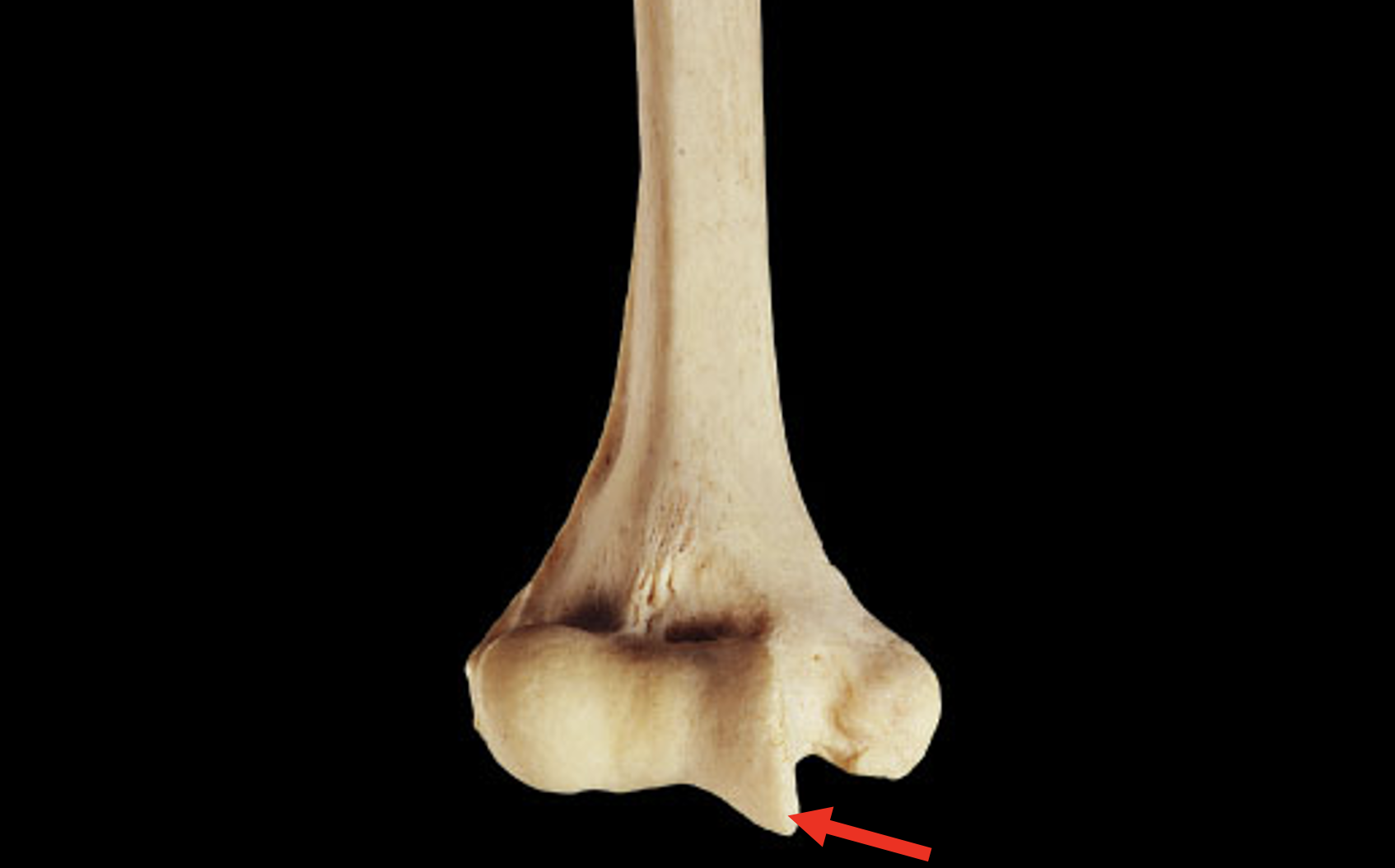 <p>Name this region of the humerus</p>