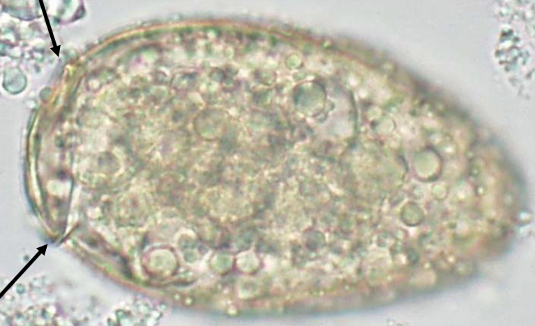 <p>Fecal flotation or sedimentation</p>
