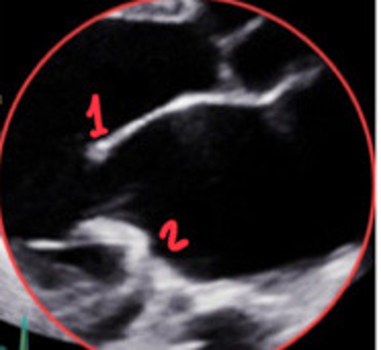 <p>What section of the MV is 1</p>