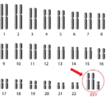 <p>(K3) Was ist das für eine Genommutation?</p>