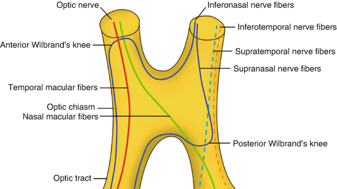 <p>inferior nasal fibers cross at chiasm and loop anteriorly to the contralateral ON before entering the optic tract</p><p>the inferior fibers cross and then loop forward towards the opposite ON and then exit</p>