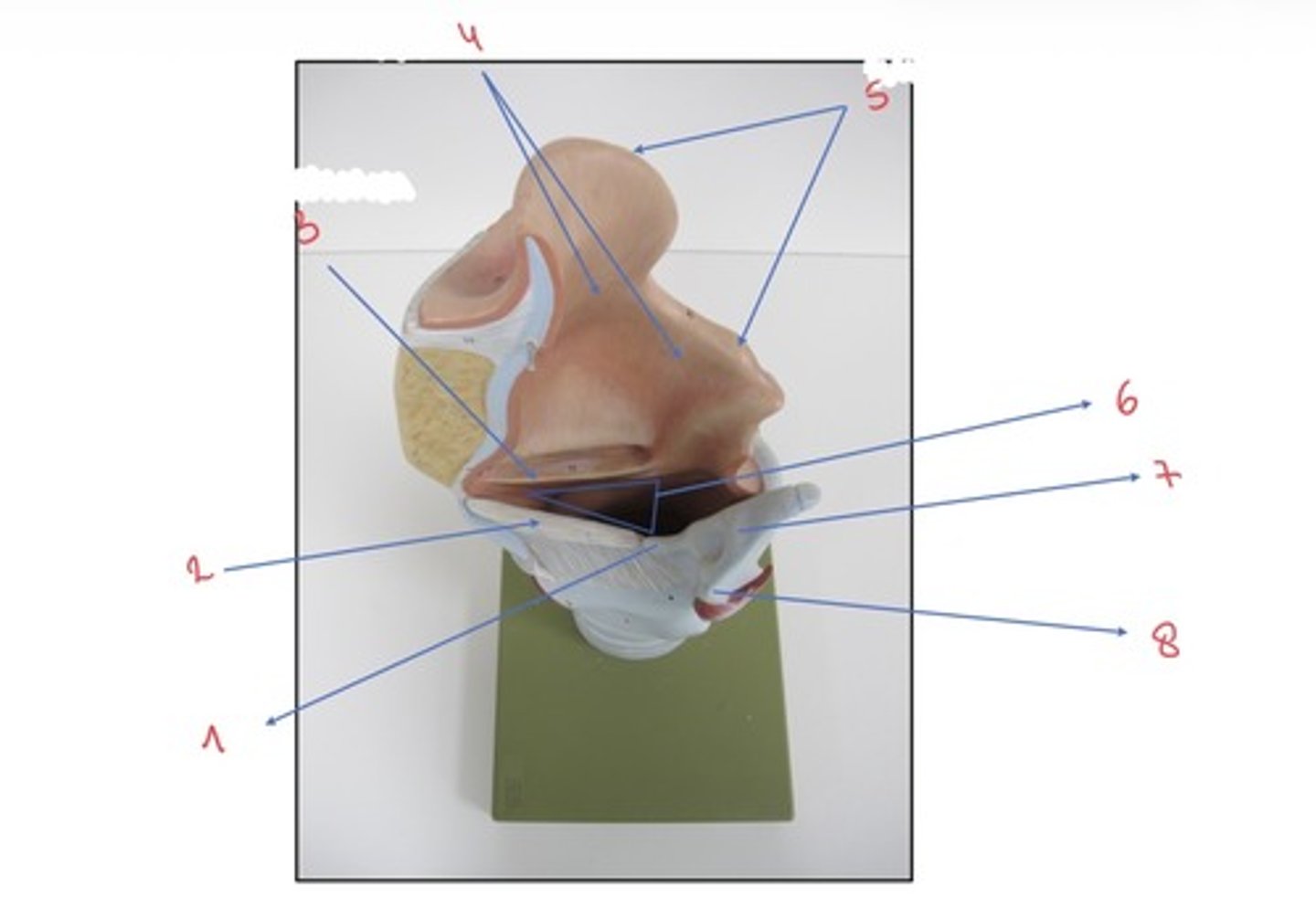 <p>wat wordt er aangeduid met 1</p>