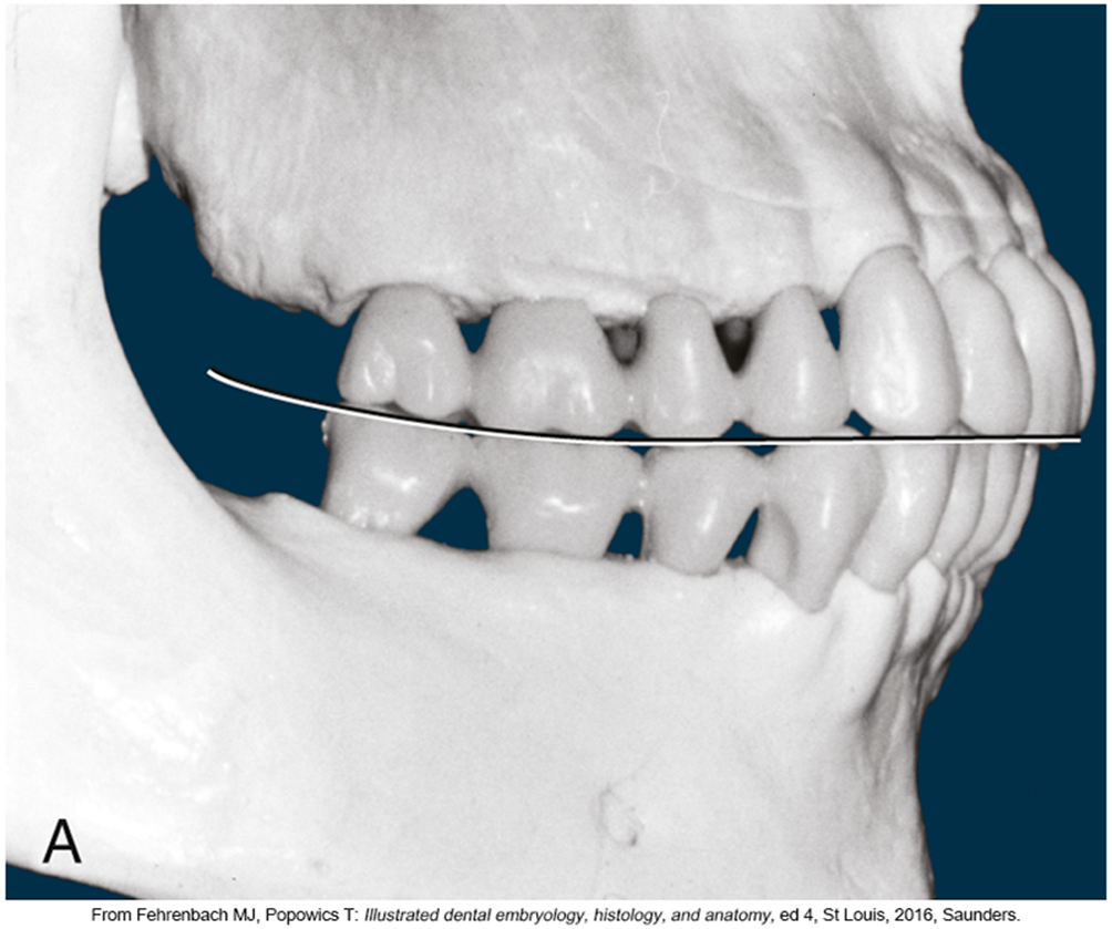 <p>The imaginary line that’s on the buccal surface, from the posterior teeth to anterior</p>