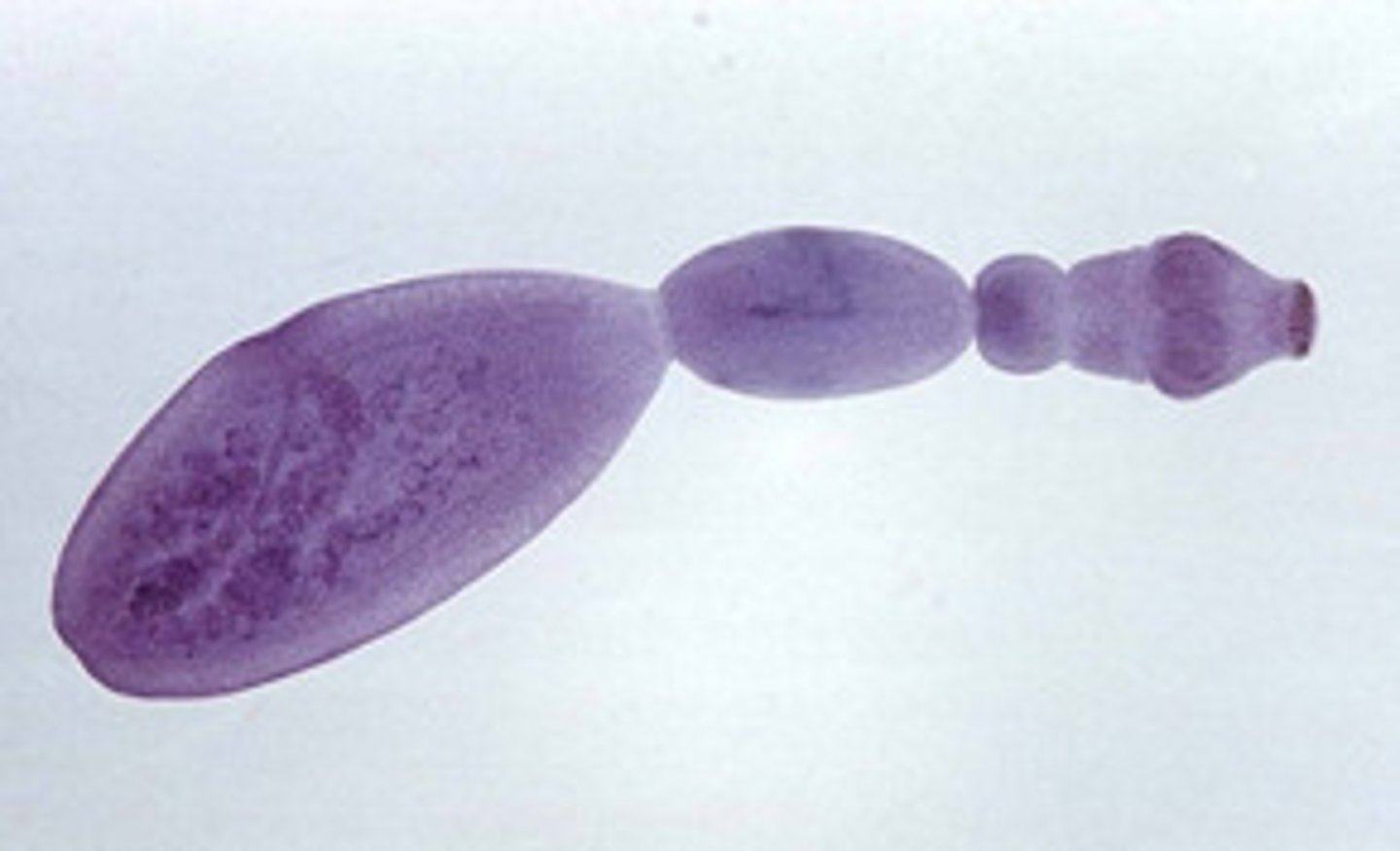 <p>- Type of cestode</p><p>- Causes a hydatid cyst to form in humans</p><p>- Dogs are the definitive host</p>