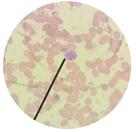 <p>what kind of white blood cells is this?</p>