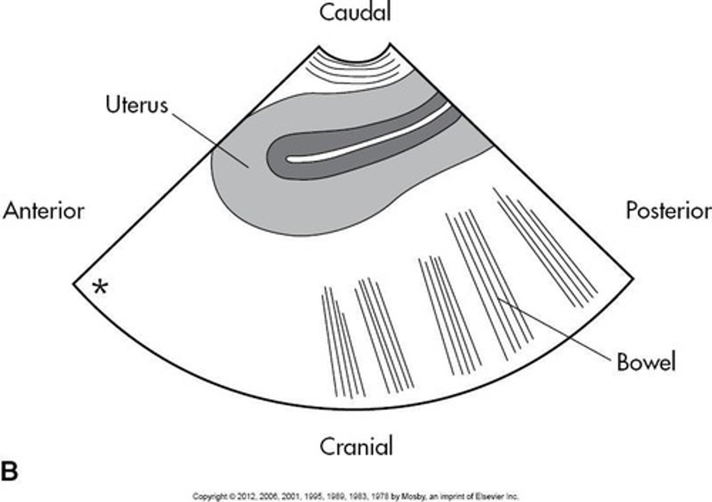 <p>Imaging bladder, uterus, and ovaries in cross-section.</p>