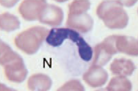 <ul><li><p>nuclear hyposegmentation</p></li><li><p>nuclear chromatin appears unsegmented</p></li><li><p>congenital defect (Aussie Shepherds)</p></li></ul><p></p>