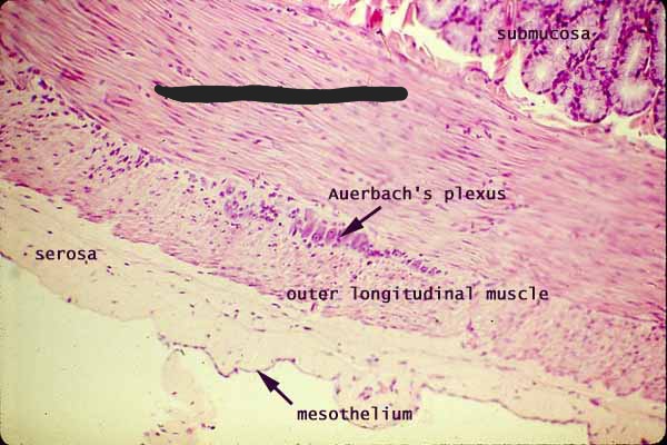 <p>Blacked out layer? Note: Intestines only</p>
