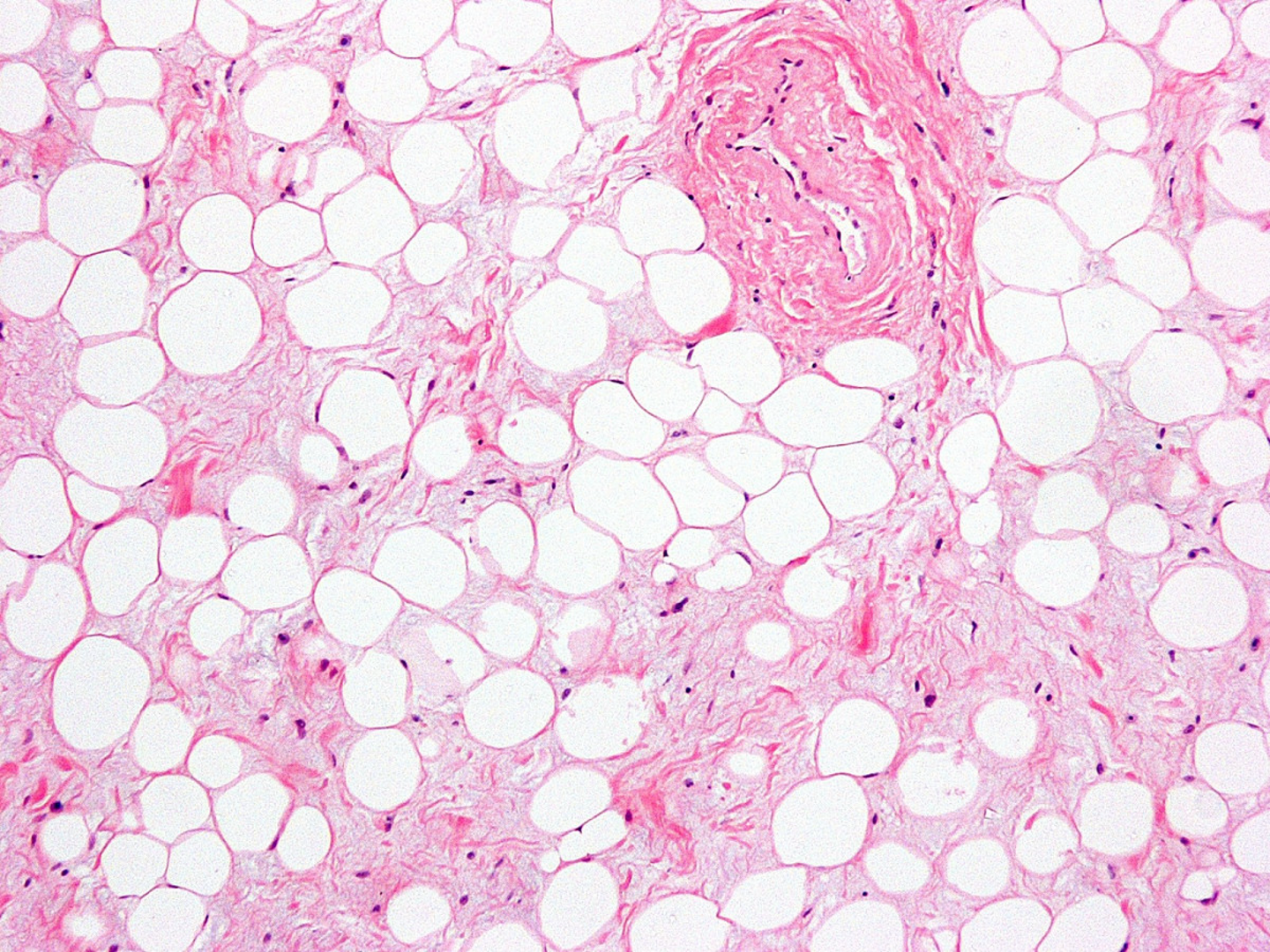<p>What type of connective tissue is characterized?</p>