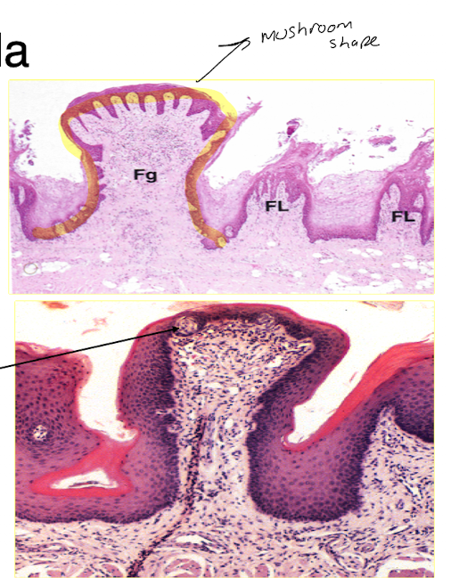<ul><li><p>look like mushrooms </p></li><li><p>concentrated in anterior portion of tongue</p></li><li><p>narrow stem, broad round top that projects above surface, red colour</p></li><li><p>taste buds are on stratified squamous on dorsal surface </p><ul><li><p>only a few taste buds on dorsal</p></li></ul></li></ul>