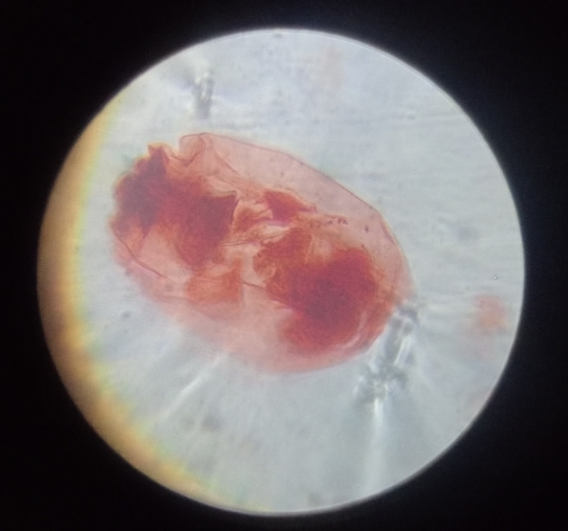 <p>Its name comes from Latin foramen meaning “hole” and -fer meaning “bearing,” referring to the tiny pores in their shells (tests) through which pseudopodia extend.</p>