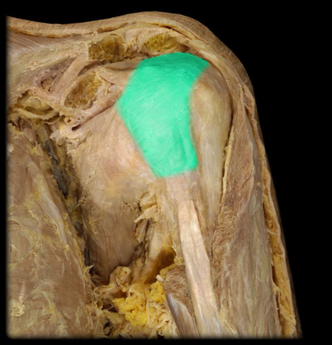 <p>What structure is shown?</p>