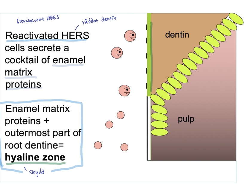 <p>1. <strong><mark data-color="green" style="background-color: green; color: inherit">HERS</mark></strong> kommer att <mark data-color="green" style="background-color: green; color: inherit">brytas ner till fragment</mark> när rotdentinet bildas vilket betyder att <mark data-color="green" style="background-color: green; color: inherit">dentinet delvis kommer blottas </mark>mot tandfolikeln (ekotomesenkymala celler).</p><p>2. <mark data-color="red" style="background-color: red; color: inherit">Ektomesenkymala cellerna reagera och försöka resorbera (bryta ner) dentinet</mark></p><p>3. Då kommer del av <mark data-color="blue" style="background-color: blue; color: inherit">HERS</mark>(Hertwigs Epitel rot skida) <mark data-color="blue" style="background-color: blue; color: inherit">fragment</mark> (som inte blivit malassez epitelrester än) <mark data-color="blue" style="background-color: blue; color: inherit">komma ihåg att de tidigare var emaljbildande celler </mark>och kommer nu <mark data-color="blue" style="background-color: blue; color: inherit">försöka </mark><strong><mark data-color="blue" style="background-color: blue; color: inherit">skydda dentinet</mark></strong></p><p>4. Epitelcellerna bildar en emaljmatrixproteincocktail som också kallas <strong><mark data-color="purple" style="background-color: purple; color: inherit">hyaline zone</mark></strong><mark data-color="purple" style="background-color: purple; color: inherit">= skyddande barriär</mark> <span style="color: rgb(147, 146, 146)">(vi räknar detta som en del av rotdentin)</span></p><ul><li><p><span style="color: rgb(146, 139, 139)">Hyaline zone = består mestadels av emalj matrix proteiner (ameloginin) + yttersta delen av rotdentin</span></p></li></ul><p></p>