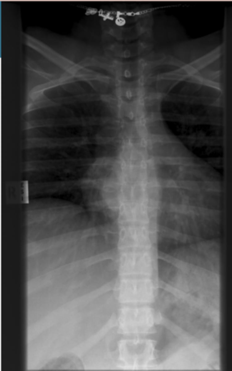 <p>Identify the positioning errors</p>