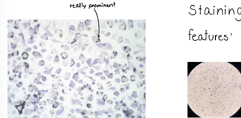 <p>Phagocytosis</p><p>staining : hematoxylin</p><p>features : black particles in different sizes, aren’t spread in the whole cell, blue nucleus</p>