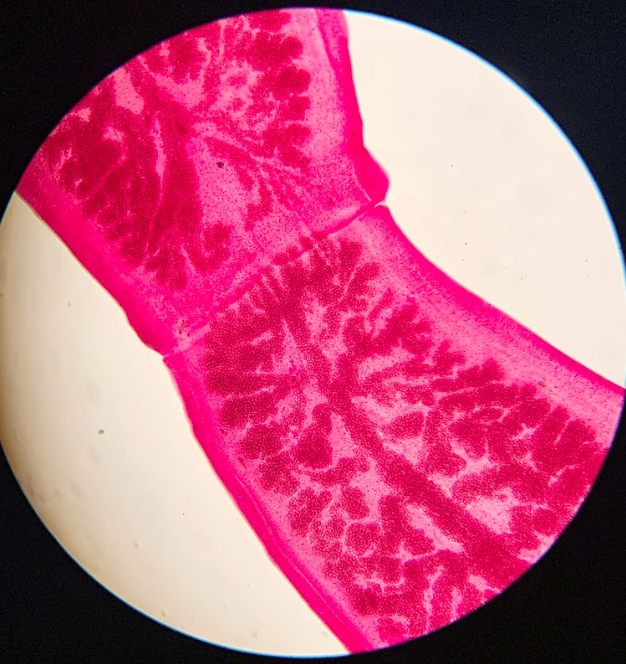 <p>Phylum?Class?<br>Symmetry? Tissue type?<br>Cavity?<br><br>Identity?</p>