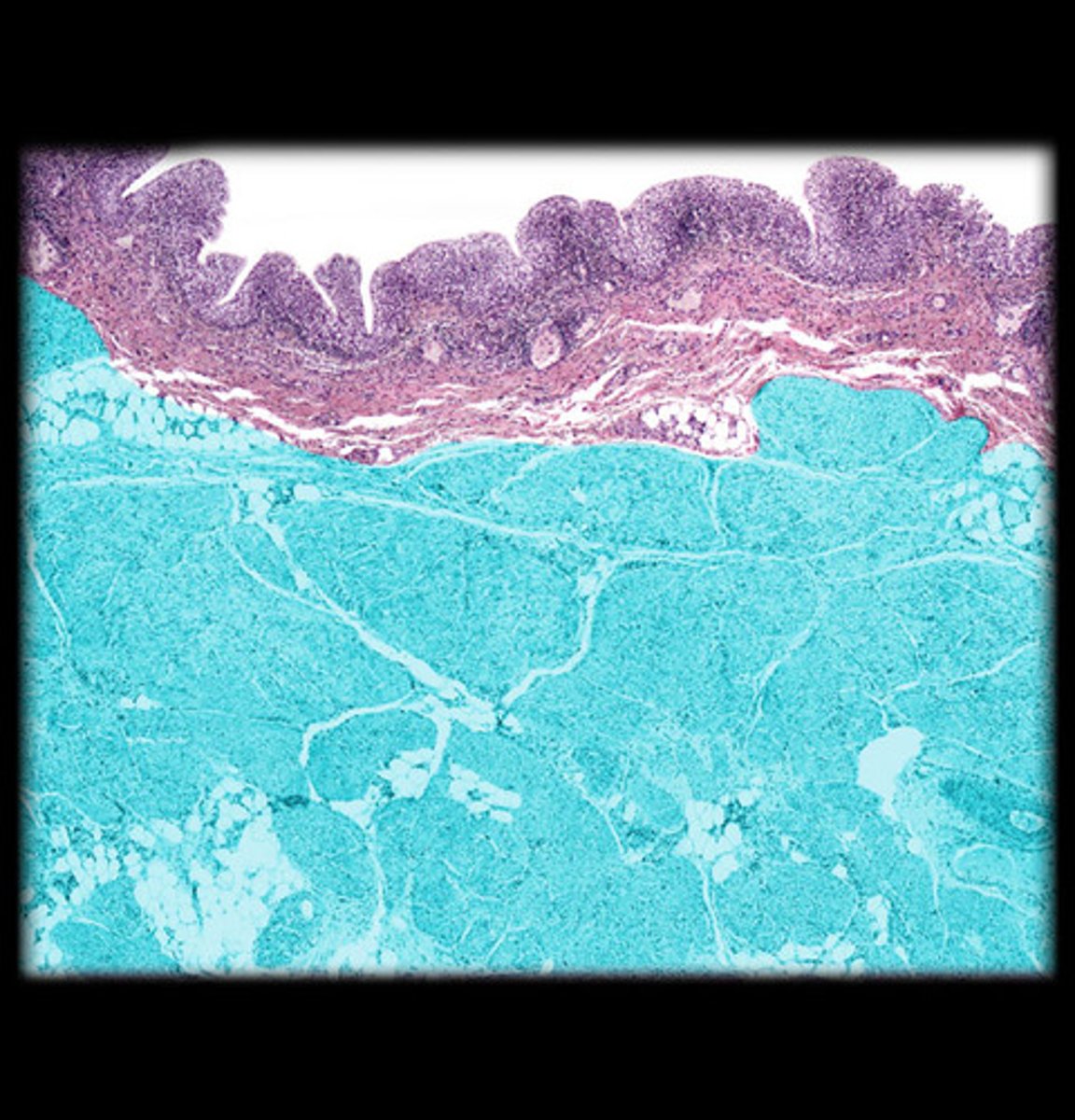 <p>Smooth muscle that contracts to drive urination</p><p>- is usually relaxed, but contracts to squeeze urine out of bladder</p>