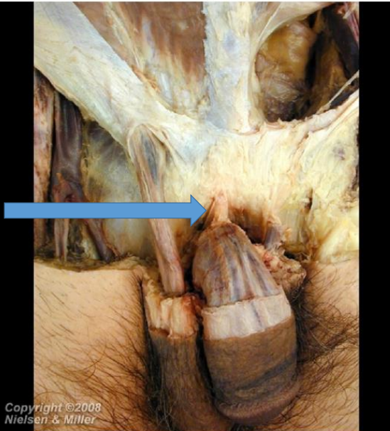 <p>What’s that &amp; what does it do</p>