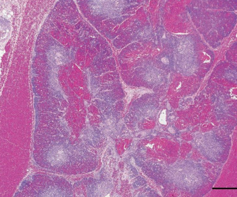 <p>What are the main histologic findings here</p>