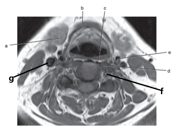 <p>What is letter f ?</p>