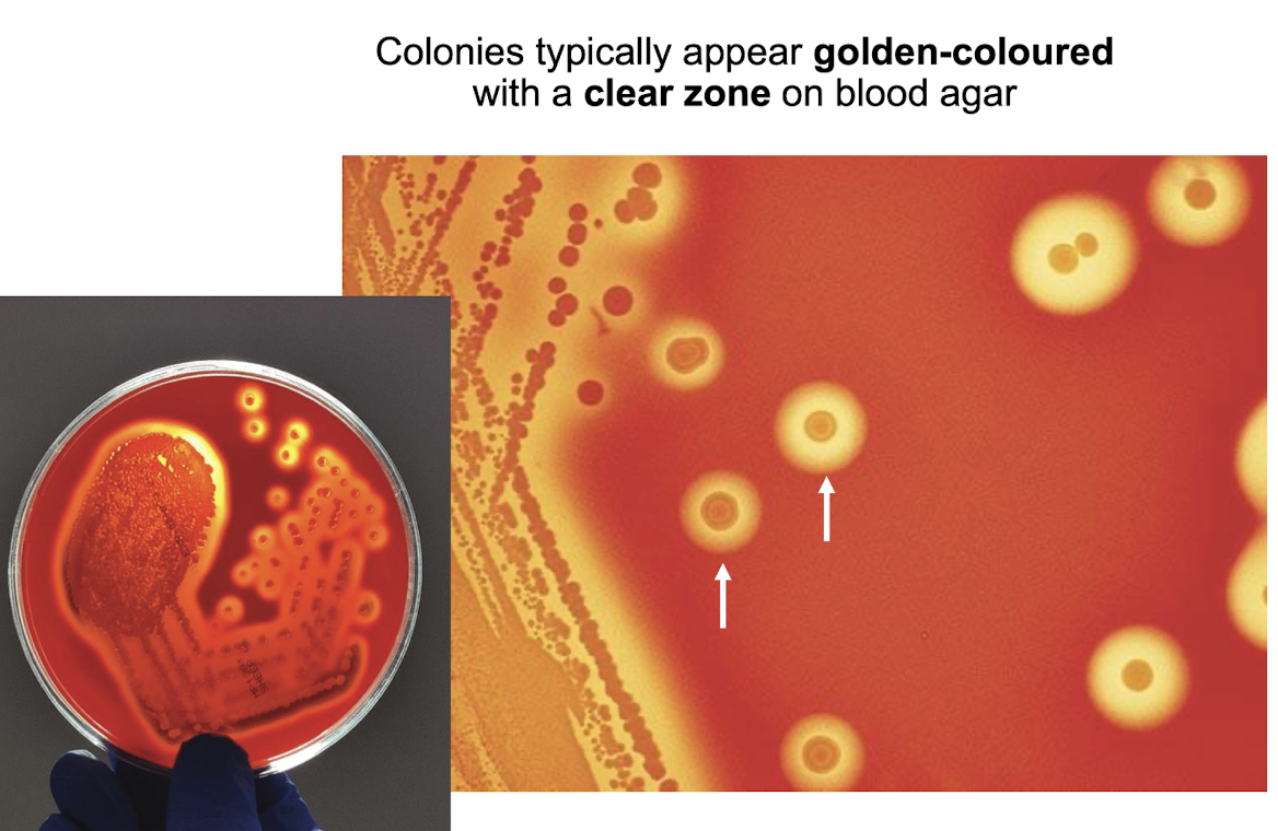 <p><strong>Dependent on the production of carotenoid pigments, primarily <mark data-color="yellow" style="background-color: yellow; color: inherit;">staphyloxanthin</mark>,</strong> which gives colours ranging from pale yellow to dark orange</p>