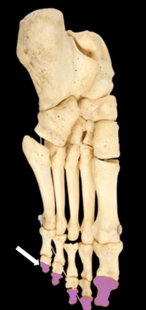 <p>name the part</p>