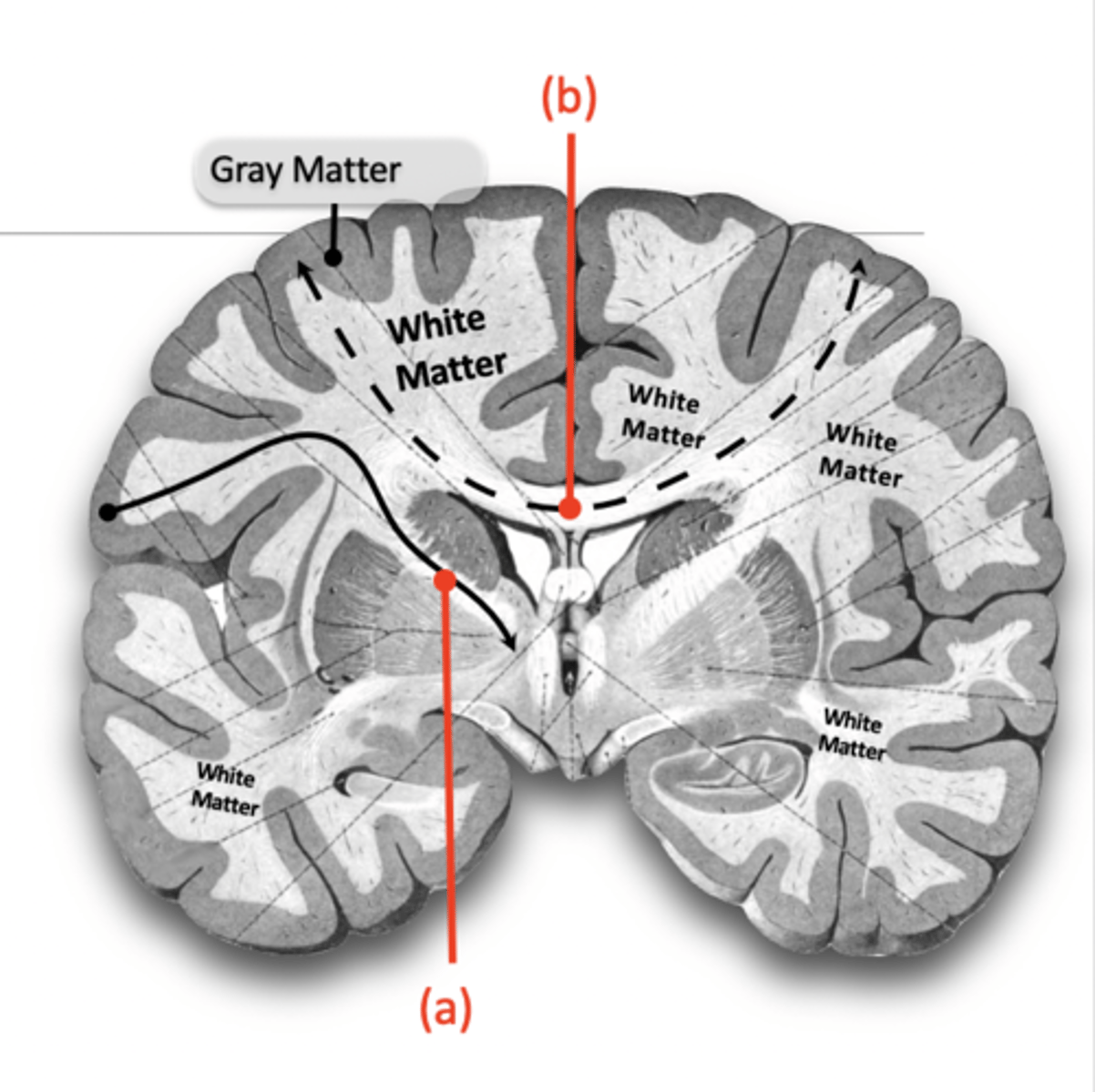 <p>Is the location of:</p><p>- Myelinated axons (also known as nerve fibers)</p><p>- Myelin covering = lighter colored tissue</p><p>White matter is found deep to gray matter of the brain</p><p>These nerve fibers travel from gray matter to gray matter, for example:</p><p>- to and from brainstem or spinal cord</p><p>- between different areas of the cortex.</p>