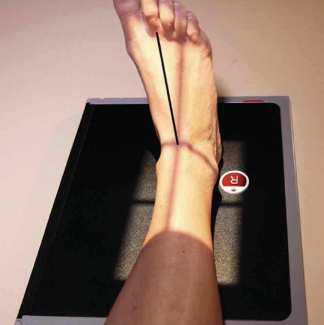 <p>What Projection is this?</p>