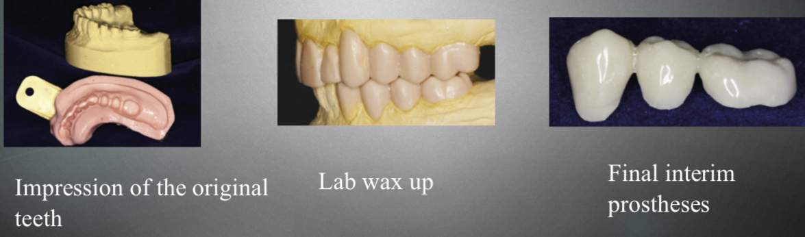 <p>Impression of teeth </p><p>Lab wax up</p><p>Form final interim procedure</p><p>Not done with patient- easier </p>