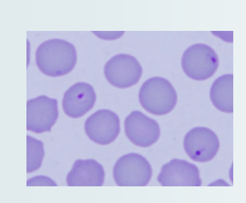 <p>What protozoan is sporadic but rapidly and uniformly a fatal disease of cats? Bobcats are the natural reservoir hosts and domestic cats surviving non-lethal infections will become reservoirs. It causes anorexia, depression, hepatosplenomegaly, leukopenia, toxic neutrophils, thrombocytopenia, and icterus/congestion of mesenteric veins.</p>