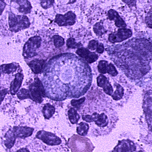 <p>Naegleria fowleri</p>